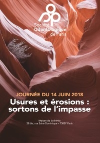 Usures et érosions : sortons de l'impasse